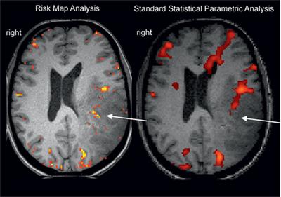 Can Functional Magnetic Resonance Imaging Generate Valid Clinical Neuroimaging Reports?